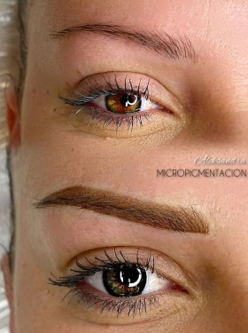 Micropigmentation - 